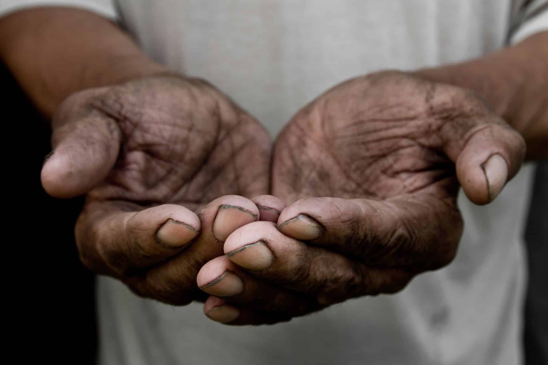 The Poor Old Mans Hands Beg You For Help The Concept Of Hunger Or Poverty Selective Focus Poverty In Retirement Alms